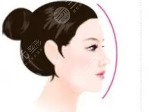 武漢美基元隆鼻修復(fù)價(jià)格隆鼻整形成功案例果分享