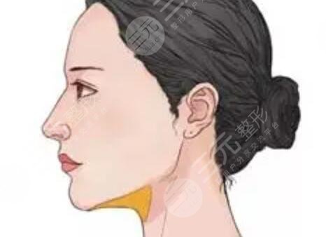 3度仿生美鼻+彩光祛雀斑+多維立體豐下頦前后對(duì)比果圖片