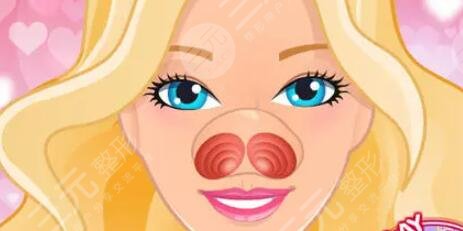 王會勇隆鼻失敗修復(fù)案例三個月恢復(fù)對比圖果分享