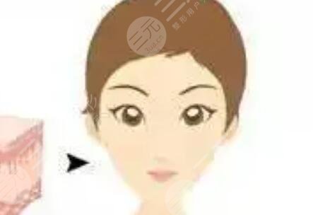 怎么變,v型,小臉,手術(shù),恢復(fù),過程,揭秘