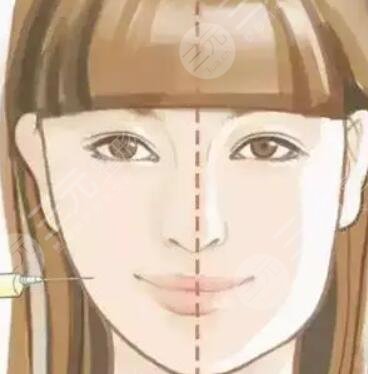 內雙,怎么變,外雙,看看,我的,手術,恢復,過程