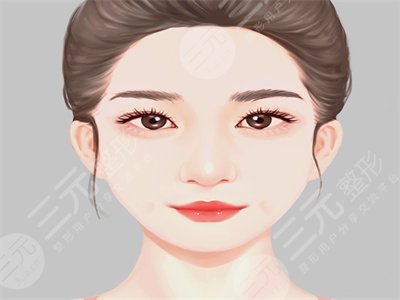 人造酒窩,手術(shù),恢復(fù),過(guò)程,前后,果,對(duì)比,圖片,案例,分享