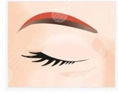 切眉手術(shù)1-7天的前后對(duì)比圖，恢復(fù)過(guò)程沒(méi)有什么后遺癥出現(xiàn)