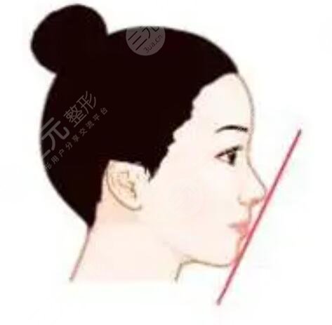 九院韋敏做的鼻子自然嗎？看一下隆鼻案例就清楚了~