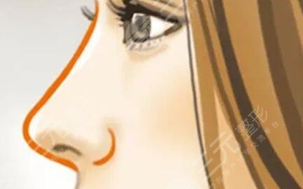 九院韋敏做的鼻子自然嗎？看一下隆鼻案例就清楚了~