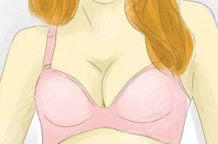 自體脂肪豐胸果對比|武侯黃氏百佳整形反饋