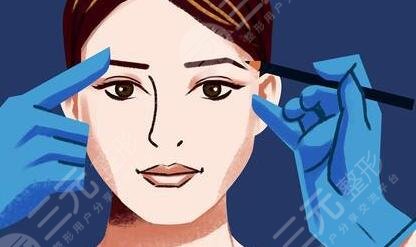 華西李正勇雙眼皮做的好不？雙眼皮圖片分享，變美就是這么簡(jiǎn)單~