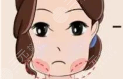 打注射瘦臉前后對比照片真實果圖