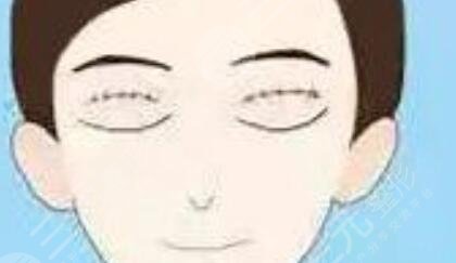 端木雪峰做過的雙眼皮圖片2