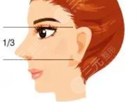 隆鼻整形術(shù)后案例 隆鼻整形真實案例