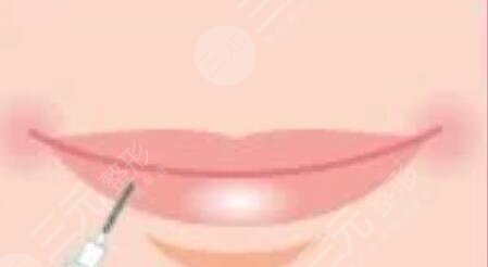 漂唇恢復(fù)七天過程圖，附個人漂唇經(jīng)歷過程圖片