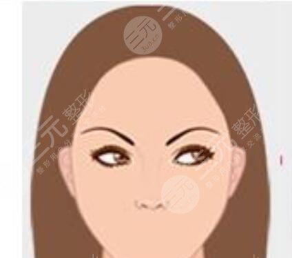 重慶大麥微針植發(fā)醫(yī)院斑禿毛發(fā)種植經(jīng)歷分享