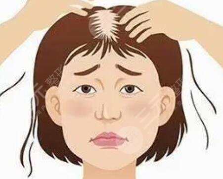 天津熙朵頭發(fā)移植怎么樣