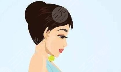 鼻骨內(nèi)推前后對比照