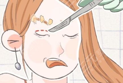 美瞳線一到七天恢復過程圖：七天左右