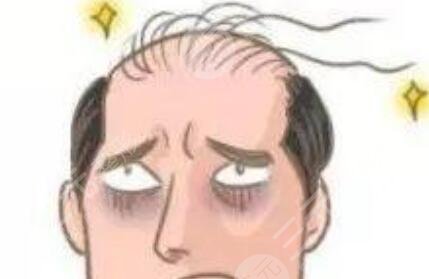 東莞壹加壹植發(fā)靠譜嗎？附黃偉醫(yī)生加密種植6個(gè)月術(shù)后果