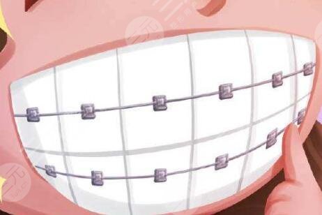 北京協(xié)和醫(yī)院種植牙怎么樣？附我的種植牙過程及術后果