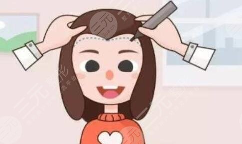 武漢熙朵植發(fā)靠譜嗎？種發(fā)際線果怎么樣？附種植后恢復(fù)圖