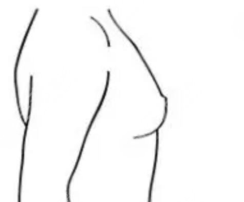 豐胸前后對(duì)比果照高清圖|圖片對(duì)比|對(duì)比一覽！