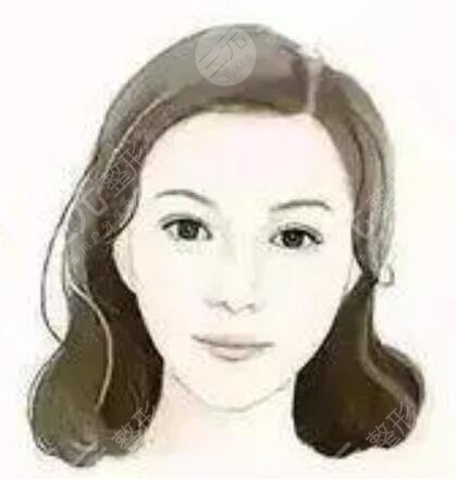 張一鳴玻尿酸填充案例