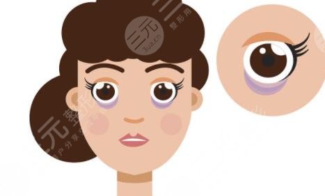 貴州省人民醫(yī)院外切眼袋手術案例，讓愛美者快速去眼袋