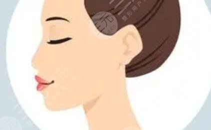 蒜頭鼻整形圖片對比