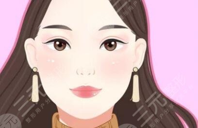 雙眼皮術(shù)后20天