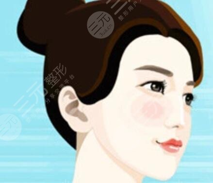 隆鼻恢復(fù)需要多久?