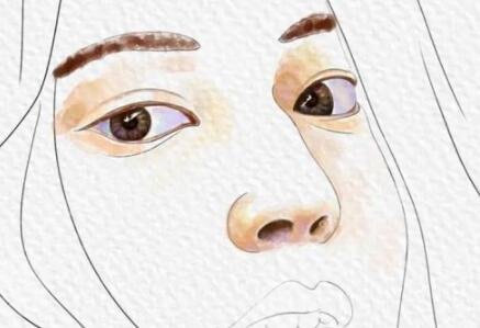 做玻尿酸填充手術(shù)后15天