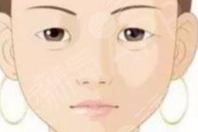 討厭自己的單眼皮，想要變成雙眼皮