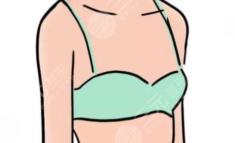 水滴型隆胸術(shù)前果圖片