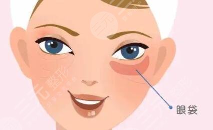 打完淚溝恢復(fù)過程圖片：真人展示填充淚溝的區(qū)別~