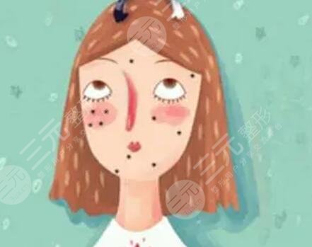 激光去痘印圖片對(duì)比