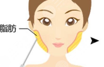 顱耳角在30°-60°之間整形手術(shù)術(shù)前