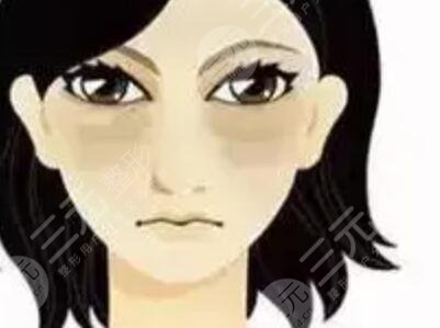 去眼袋手術(shù)圖片對比：從憔悴到元?dú)鉂M滿的轉(zhuǎn)變！