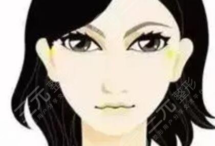 去眼袋手術(shù)情況