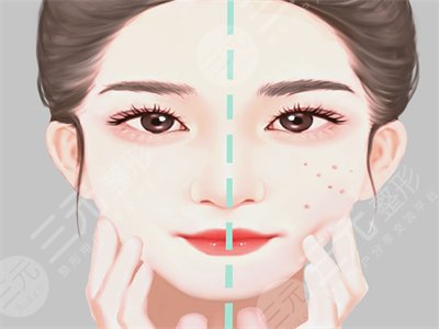 聽(tīng)說(shuō)“顱耳角在30°-60°之間”火爆全網(wǎng)？說(shuō)說(shuō)我做顱耳角在30°-60°之間注射整形的感受吧~