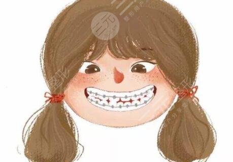 洗牙、牙齒美白