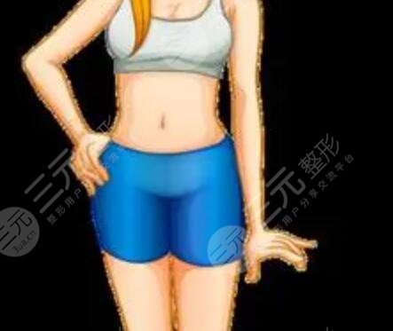 上海愛都瀘美人大腿吸脂案例