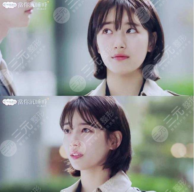 裴秀智微整泡到李敏鎬！從土氣女孩到韓劇女主？她動了哪些地方？