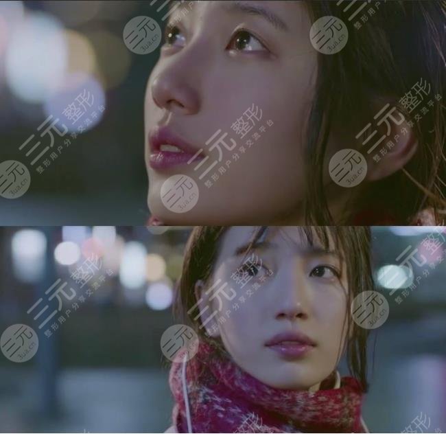 【裴秀智整容了嗎】