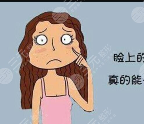 徐州二院激光祛痘印果圖+價格