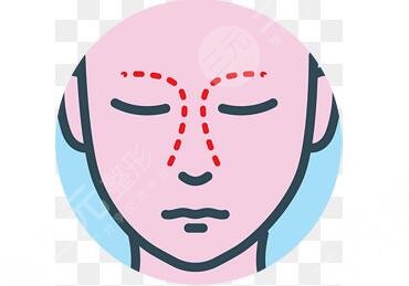 寶雞人民醫(yī)院整形美容科隆鼻案例分享