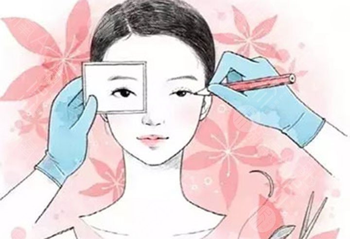 雙眼皮手術前