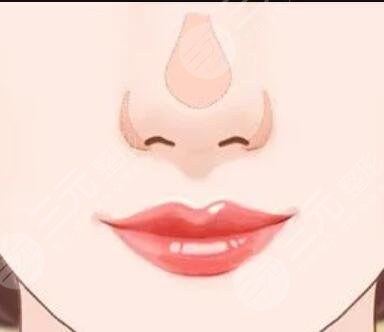 深圳雅星醫(yī)療美容醫(yī)院綜合鼻案例