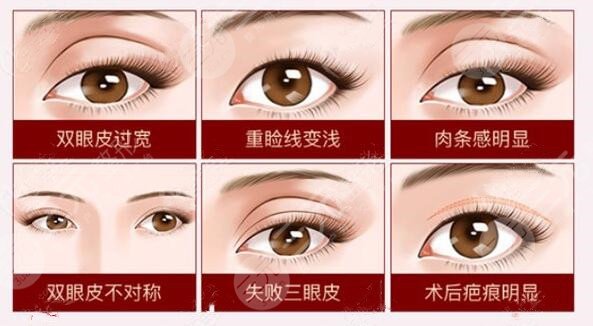 國內(nèi)眼修復項目科普