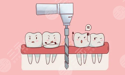 上海九院牙科擅長項(xiàng)目：