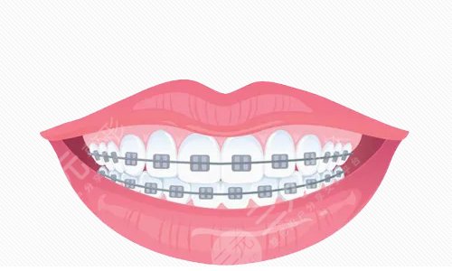 上海九院牙科擅長項(xiàng)目：