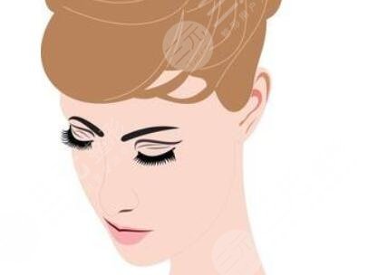 北京清木雙眼皮案例