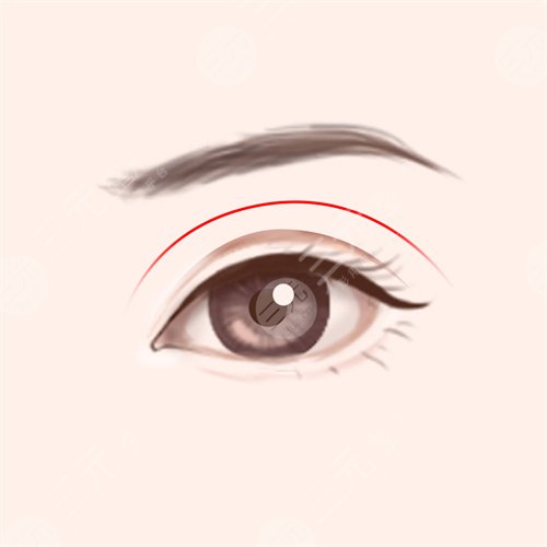 黃勝華醫(yī)生眼部手術(shù)術(shù)后